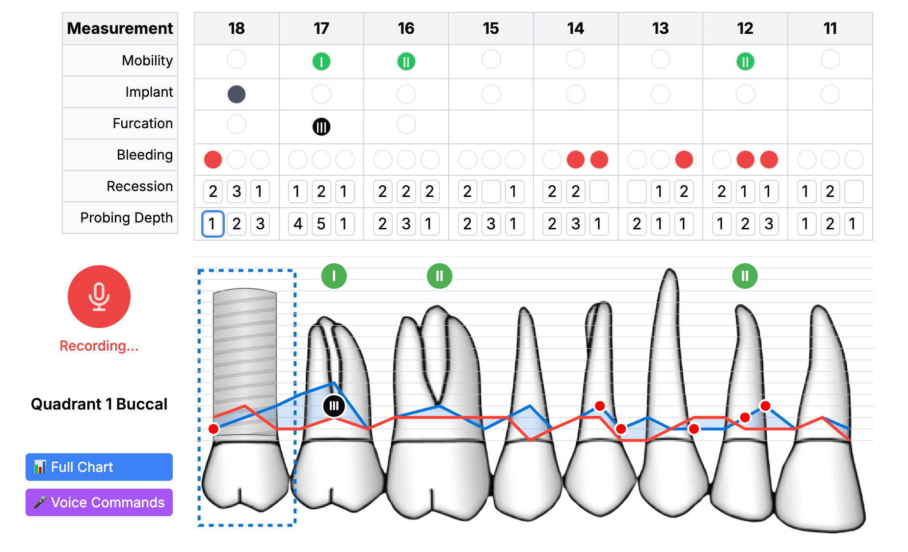 ChatPerio Software Interface